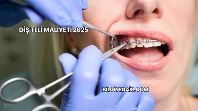 Diş Teli Maliyeti 2025