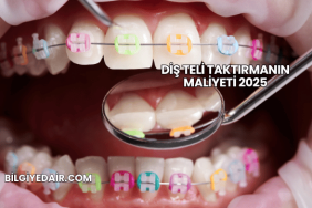 Diş Teli Taktırmanın Maliyeti 2025