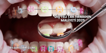 Diş Teli Taktırmanın Maliyeti 2025