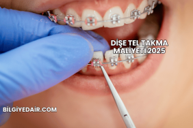 Dişe Tel Takma Maliyeti 2025