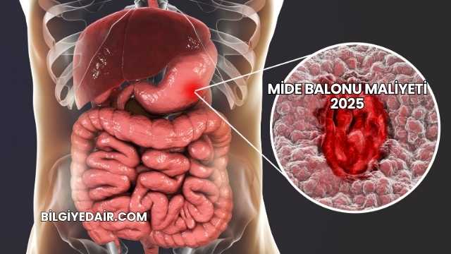 Mide Balonu Maliyeti 2025